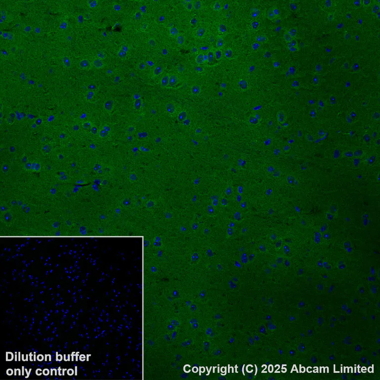 Immunohistochemistry (Formalin/PFA-fixed paraffin-embedded sections) - Alexa Fluor® 568 Anti-PAK1 antibody [EPR26067-45] (AB325259)