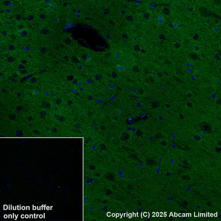 Immunohistochemistry (Formalin/PFA-fixed paraffin-embedded sections) - Alexa Fluor® 568 Anti-PAK1 antibody [EPR26067-45] (AB325259)