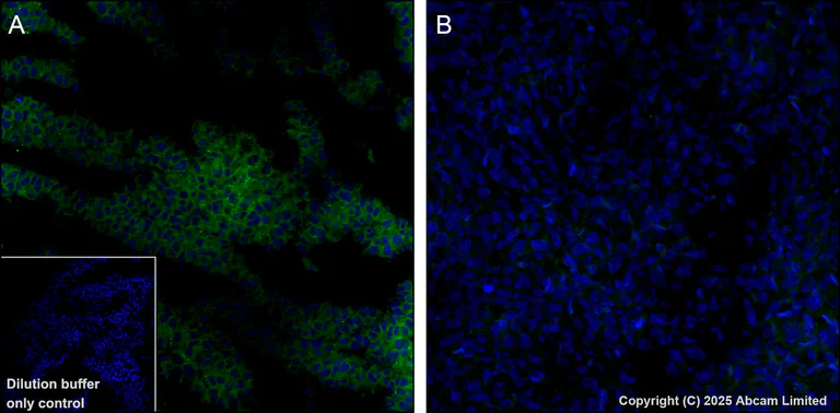 Immunohistochemistry (Formalin/PFA-fixed paraffin-embedded sections) - Alexa Fluor® 568 Anti-PAK1 antibody [EPR26067-45] (AB325259)