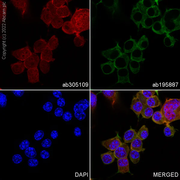 Immunocytochemistry/ Immunofluorescence - Alexa Fluor® 568 Anti-PGP9.5 antibody [EPR4118] - Neuronal Marker (AB305109)