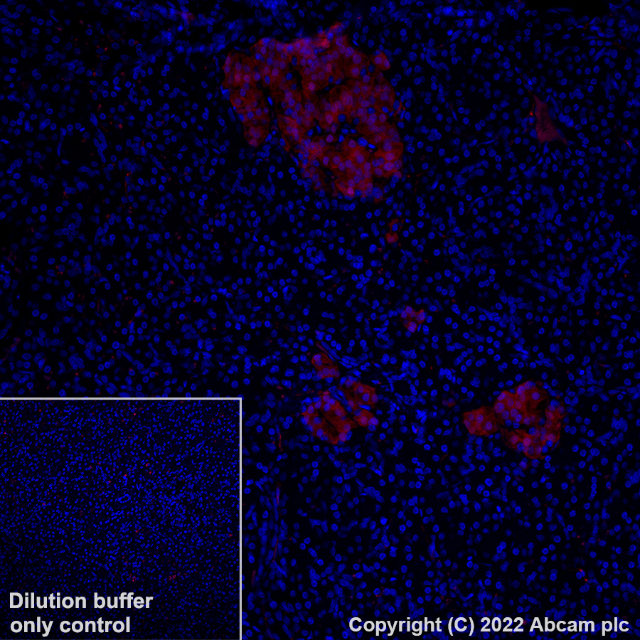 Immunohistochemistry (Formalin/PFA-fixed paraffin-embedded sections) - Alexa Fluor® 568 Anti-PGP9.5 antibody [EPR4118] - Neuronal Marker (AB305109), expandable thumbnail