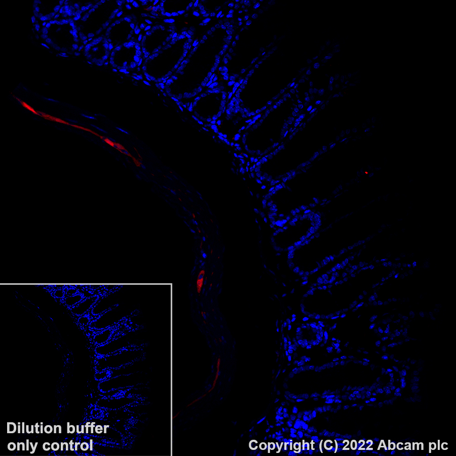 Immunohistochemistry (Formalin/PFA-fixed paraffin-embedded sections) - Alexa Fluor® 568 Anti-PGP9.5 antibody [EPR4118] - Neuronal Marker (AB305109), expandable thumbnail