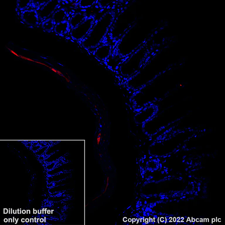 Immunohistochemistry (Formalin/PFA-fixed paraffin-embedded sections) - Alexa Fluor® 568 Anti-PGP9.5 antibody [EPR4118] - Neuronal Marker (AB305109)