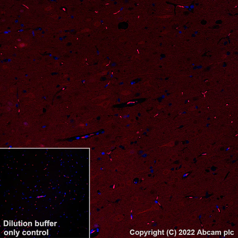Immunohistochemistry (Formalin/PFA-fixed paraffin-embedded sections) - Alexa Fluor® 568 Anti-PGP9.5 antibody [EPR4118] - Neuronal Marker (AB305109)