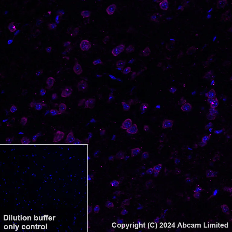 Immunohistochemistry (Formalin/PFA-fixed paraffin-embedded sections) - Alexa Fluor® 568 Anti-PSMA antibody [EPR28358-8] (AB320703)