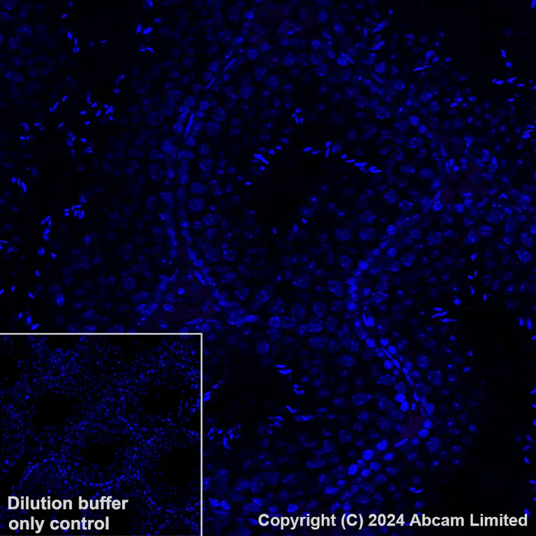 Immunohistochemistry (Formalin/PFA-fixed paraffin-embedded sections) - Alexa Fluor® 568 Anti-PSMA antibody [EPR28358-8] (AB320703)
