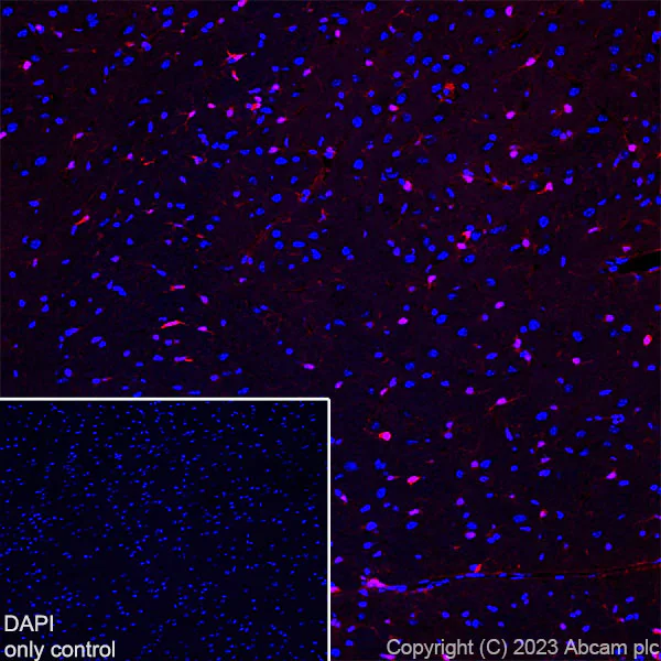 Immunohistochemistry (Frozen sections) - Alexa Fluor® 568 Anti-S100 beta antibody [EP1576Y] - Astrocyte Marker (AB313817)