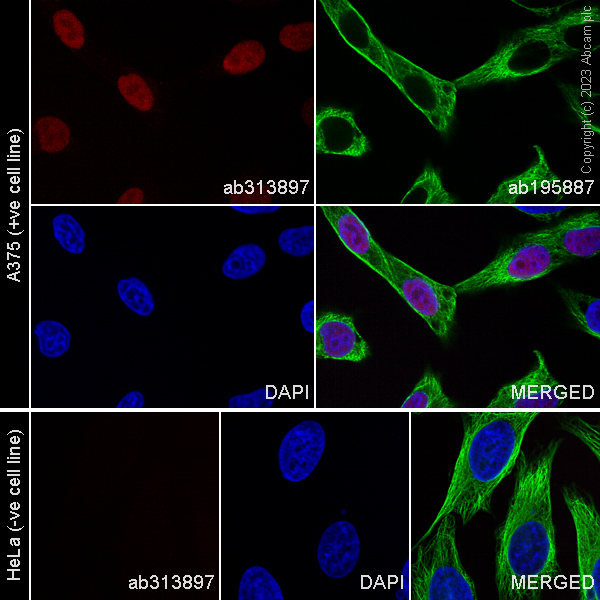 Immunocytochemistry/ Immunofluorescence - Alexa Fluor® 568 Anti-SOX10 antibody [SP267] (AB313897), expandable thumbnail