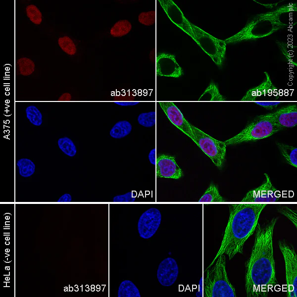 Immunocytochemistry/ Immunofluorescence - Alexa Fluor® 568 Anti-SOX10 antibody [SP267] (AB313897)