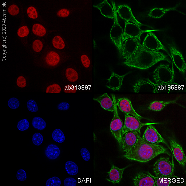 Immunocytochemistry/ Immunofluorescence - Alexa Fluor® 568 Anti-SOX10 antibody [SP267] (AB313897), expandable thumbnail