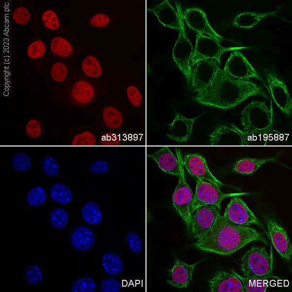 Immunocytochemistry/ Immunofluorescence - Alexa Fluor® 568 Anti-SOX10 antibody [SP267] (AB313897)
