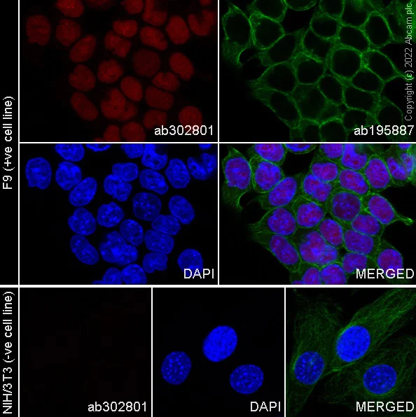 Immunocytochemistry/ Immunofluorescence - Alexa Fluor® 568 Anti-SOX2 antibody [EPR3131] (AB302801)