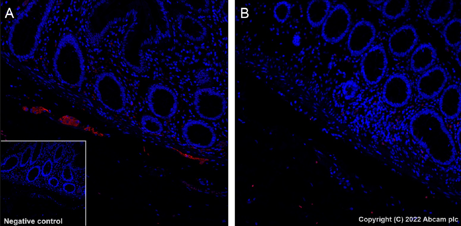 Immunohistochemistry (Formalin/PFA-fixed paraffin-embedded sections) - Alexa Fluor® 568 Anti-Tau (phospho S396) antibody [EPR2731] (AB302804)