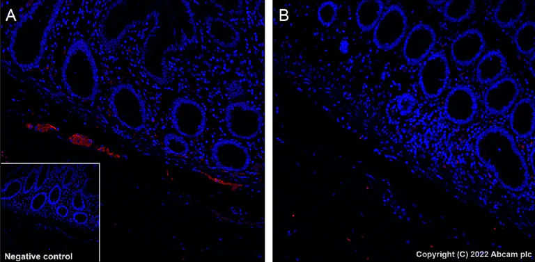 Immunohistochemistry (Formalin/PFA-fixed paraffin-embedded sections) - Alexa Fluor® 568 Anti-Tau (phospho S396) antibody [EPR2731] (AB302804)