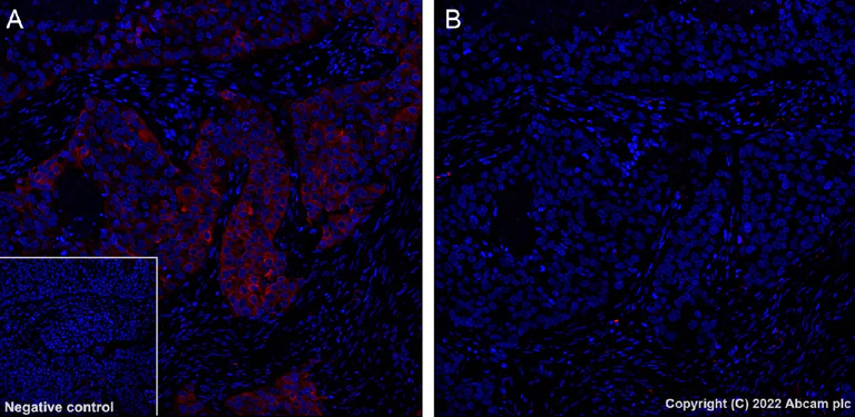 Immunohistochemistry (Formalin/PFA-fixed paraffin-embedded sections) - Alexa Fluor® 568 Anti-Tau (phospho S396) antibody [EPR2731] (AB302804)