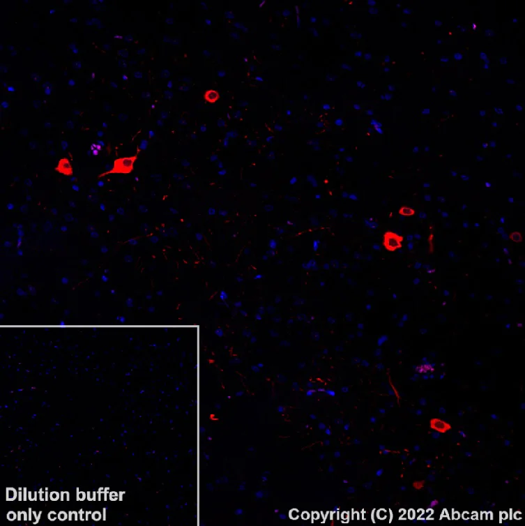 Immunohistochemistry (Formalin/PFA-fixed paraffin-embedded sections) - Alexa Fluor® 568 Anti-Tyrosine Hydroxylase antibody [EP1532Y] - Neuronal Marker (AB302968)