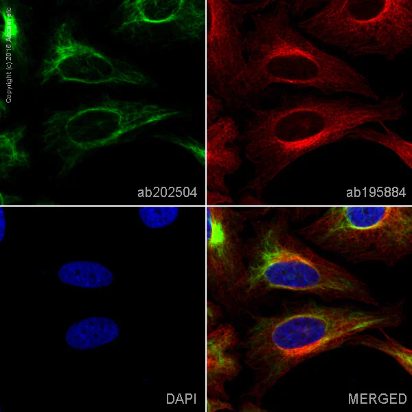 Anti-Vimentin Alexa Fluor® 568 antibody [EPR3776] (ab202504) IgG