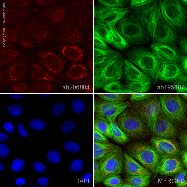 Immunocytochemistry/ Immunofluorescence - Alexa Fluor® 594 Anti-ALDH1A1 antibody [EP1933Y] (AB206884)