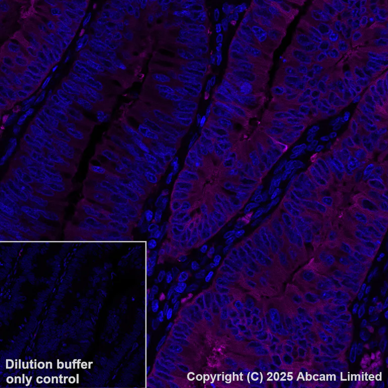 Immunohistochemistry (Formalin/PFA-fixed paraffin-embedded sections) - Alexa Fluor® 594 Anti-ALDH1A1 antibody [EP1933Y] (AB206884)