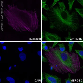Immunocytochemistry/ Immunofluorescence - Alexa Fluor® 594 Anti-alpha smooth muscle Actin antibody [1A4] (AB202368)