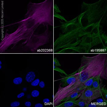 Immunocytochemistry/ Immunofluorescence - Alexa Fluor® 594 Anti-alpha smooth muscle Actin antibody [1A4] (AB202368)