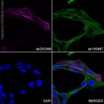 Alexa Fluor® 594 conjugated Anti-alpha smooth muscle Actin
