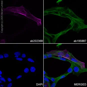 Immunocytochemistry/ Immunofluorescence - Alexa Fluor® 594 Anti-alpha smooth muscle Actin antibody [1A4] (AB202368)