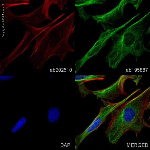 Immunocytochemistry/ Immunofluorescence - Alexa Fluor® 594 Anti-alpha smooth muscle Actin antibody [EPR5368] (AB202510)
