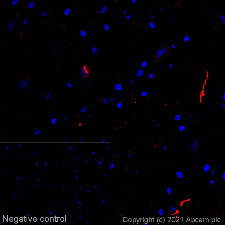 Immunohistochemistry (Frozen sections) - Alexa Fluor® 594 Anti-Alpha-synuclein aggregate antibody [MJFR-14-6-4-2] (AB283628)