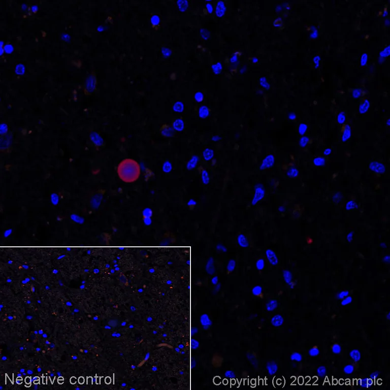 Alexa Fluor® 594 conjugated Anti-Alpha-synuclein (phospho