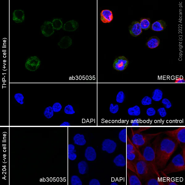 Immunocytochemistry - Alexa Fluor® 594 Anti-alpha Tubulin antibody [DM1A] - Microtubule Marker (AB195889)
