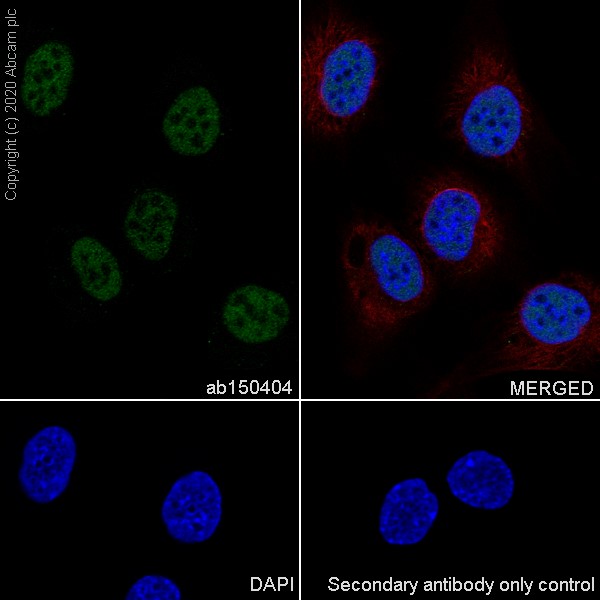 Anti-alpha Tubulin Alexa Fluor® 594 antibody [DM1A