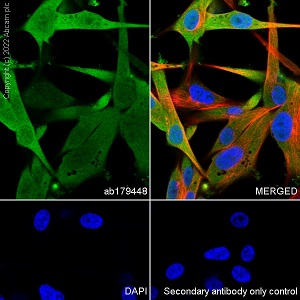 Immunocytochemistry/ Immunofluorescence - Alexa Fluor® 594 Anti-alpha Tubulin antibody [DM1A] - Microtubule Marker (ab195889), expandable thumbnail