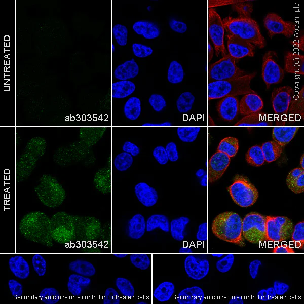 Immunocytochemistry/ Immunofluorescence - Alexa Fluor® 594 Anti-alpha Tubulin antibody [DM1A] - Microtubule Marker (AB195889)