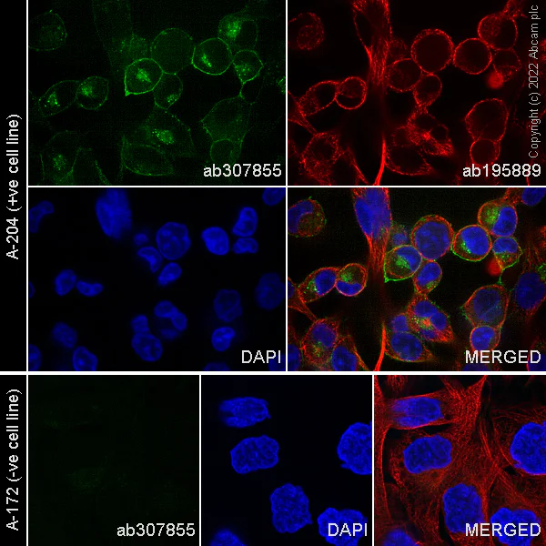 Immunocytochemistry/ Immunofluorescence - Alexa Fluor® 594 Anti-alpha Tubulin antibody [DM1A] - Microtubule Marker (AB195889)