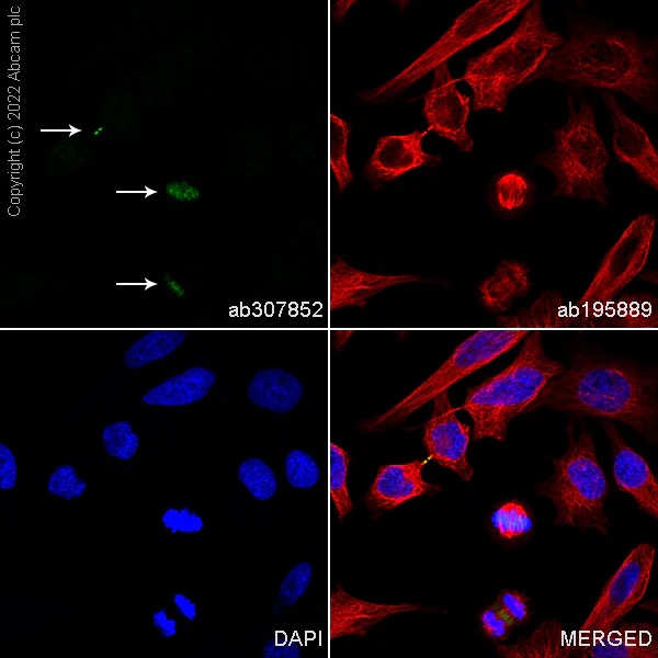 Immunocytochemistry/ Immunofluorescence - Alexa Fluor® 594 Anti-alpha Tubulin antibody [DM1A] - Microtubule Marker (AB195889)