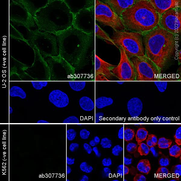 Immunocytochemistry/ Immunofluorescence - Alexa Fluor® 594 Anti-alpha Tubulin antibody [DM1A] - Microtubule Marker (AB195889)