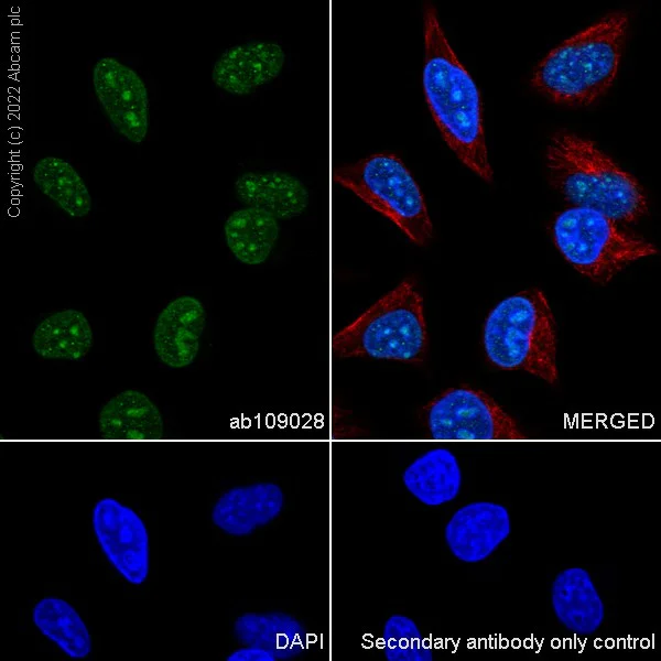 Immunocytochemistry/ Immunofluorescence - Alexa Fluor® 594 Anti-alpha Tubulin antibody [DM1A] - Microtubule Marker (AB195889)