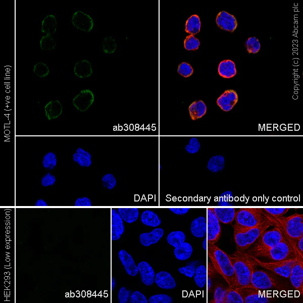 Immunocytochemistry/ Immunofluorescence - Alexa Fluor® 594 Anti-alpha Tubulin antibody [DM1A] - Microtubule Marker (AB195889)