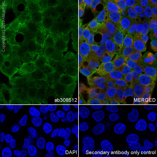 Immunocytochemistry/ Immunofluorescence - Alexa Fluor® 594 Anti-alpha Tubulin antibody [DM1A] - Microtubule Marker (AB195889)