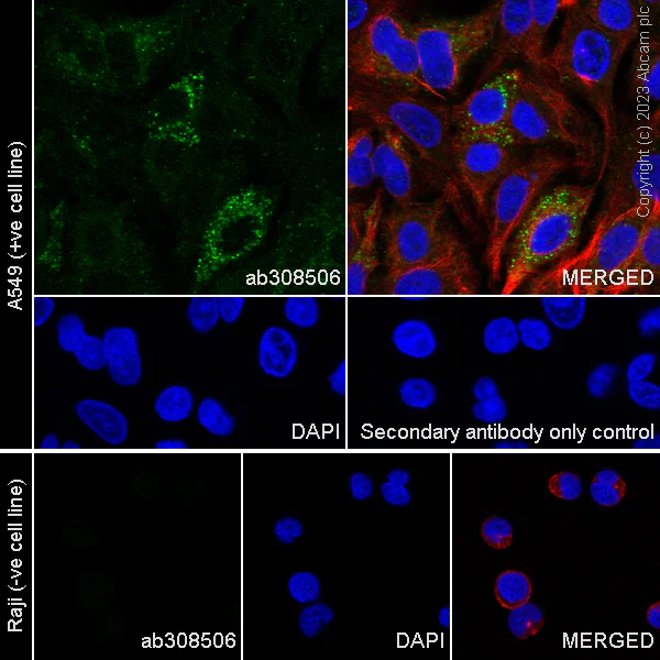 Immunocytochemistry/ Immunofluorescence - Alexa Fluor® 594 Anti-alpha Tubulin antibody [DM1A] - Microtubule Marker (AB195889)