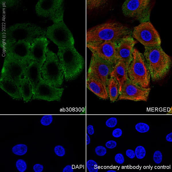 Immunocytochemistry/ Immunofluorescence - Alexa Fluor® 594 Anti-alpha Tubulin antibody [DM1A] - Microtubule Marker (AB195889)