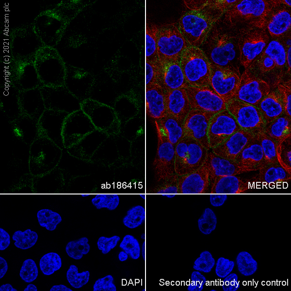 Immunocytochemistry/ Immunofluorescence - Alexa Fluor® 594 Anti-alpha Tubulin antibody [DM1A] - Microtubule Marker (ab195889), expandable thumbnail