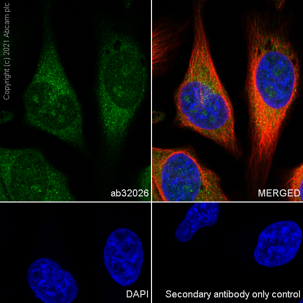 Immunocytochemistry/ Immunofluorescence - Alexa Fluor® 594 Anti-alpha Tubulin antibody [DM1A] - Microtubule Marker (ab195889), expandable thumbnail