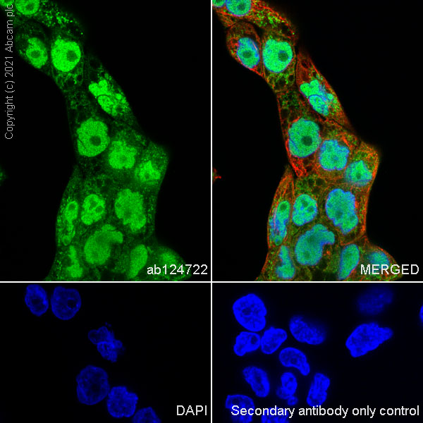 Immunocytochemistry/ Immunofluorescence - Alexa Fluor® 594 Anti-alpha Tubulin antibody [DM1A] - Microtubule Marker (ab195889), expandable thumbnail