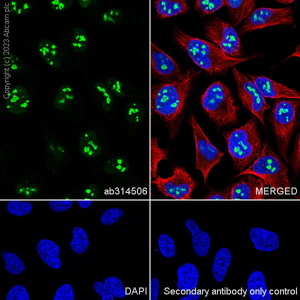 Immunocytochemistry/ Immunofluorescence - Alexa Fluor® 594 Anti-alpha Tubulin antibody [DM1A] - Microtubule Marker (AB195889)