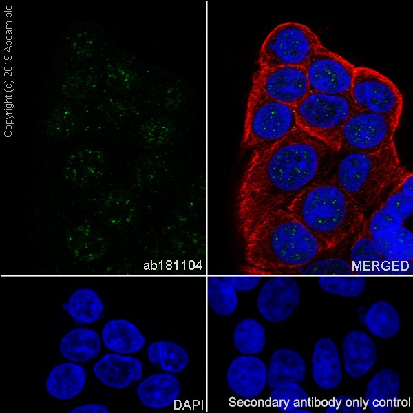 Immunocytochemistry/ Immunofluorescence - Alexa Fluor® 594 Anti-alpha Tubulin antibody [DM1A] - Microtubule Marker (ab195889), expandable thumbnail
