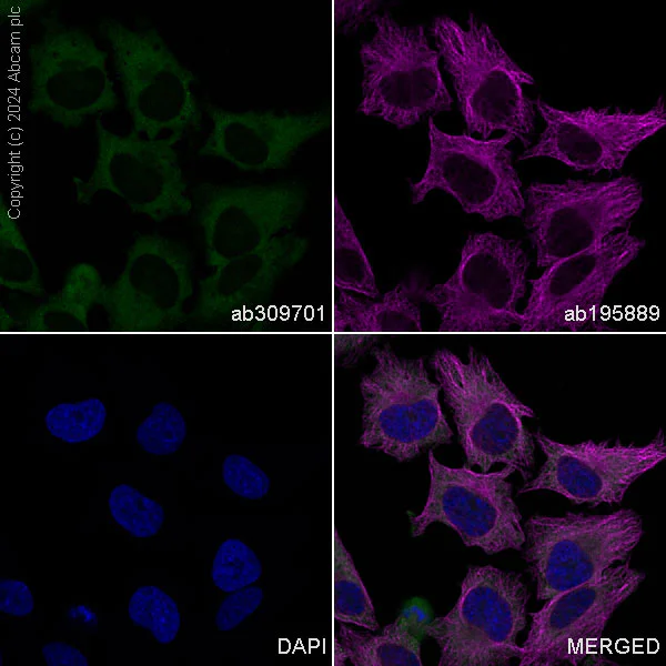 Immunocytochemistry/ Immunofluorescence - Alexa Fluor® 594 Anti-alpha Tubulin antibody [DM1A] - Microtubule Marker (AB195889)
