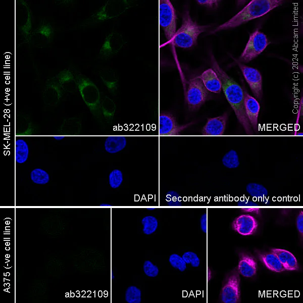 Immunocytochemistry/ Immunofluorescence - Alexa Fluor® 594 Anti-alpha Tubulin antibody [DM1A] - Microtubule Marker (AB195889)