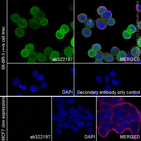 Immunocytochemistry/ Immunofluorescence - Alexa Fluor® 594 Anti-alpha Tubulin antibody [DM1A] - Microtubule Marker (AB195889)